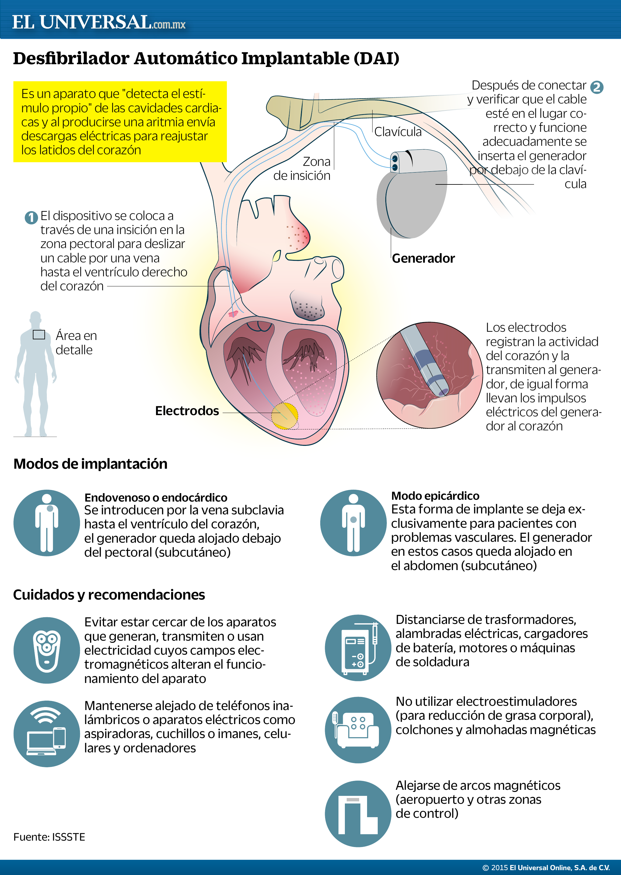 Des Brilador Automatico Implantable Dai