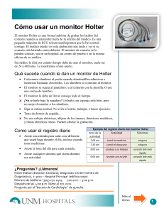 Cómo usar un monitor Holter