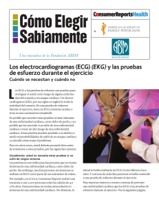 Los electrocardiogramas (ECG) (EKG) y las pruebas de esfuerzo