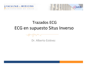 ECG en supuesto Situs Inverso - Bases de la Medicina Clínica