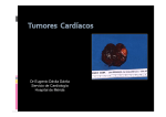 Diagnóstico por Imagen de Tumores Cardiacos.