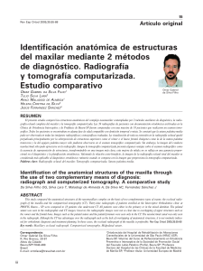 Artículo original Identificación anatómica de estructuras del maxilar