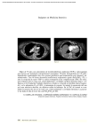 PDF - Medicina Intensiva