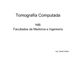 Instrumentación de Tomografía Computada