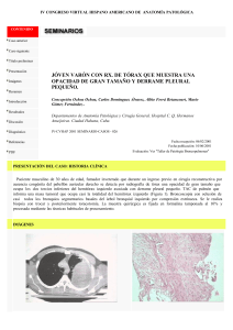 j&oacute;ven var&oacute;n con rx. de t&oacute;rax que muestra una opacidad de gran