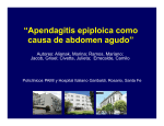 “Apendagitis epiploica como causa de abdomen agudo”