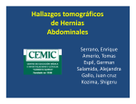 Hallazgos tomográficos de Hernias Abdominales