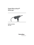 Digital MacroView™ Otoscopio–Instrucciones de uso