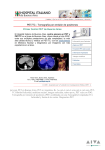 PET/TC - Tomografía por emisión de positrones - Aiva