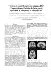 Técnicas de cuantificación de imágenes PET (Tomografía por