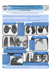 Caracterización tomografica de lesiones cavitadas