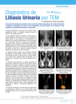 Litiasis Urinaria por TEM Diagnóstico de