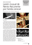 Lesión inusual de Nervio Recurrente por herida cervical