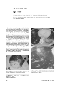 Signo del halo - Revista de Patolog&iacute;a Respiratoria