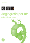 Caso Angiografía por RMI - Servicios Médicos Vistazo SA