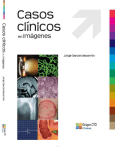 Casos Clinicos en Imagenes CTO