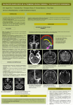 valoración radiológica de la trombosis venosa cerebral y su