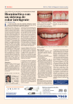 Estética - Dental Tribune International