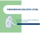 Intubación con Fibroscopía