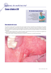 Caso clínico LIV Imágenes de medicina oral