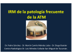 IRM de la patología frecuente de la ATM