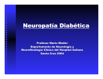Neuropatía diabética