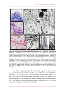 Los criterios diagnósticos han ido variando a lo largo de los años en
