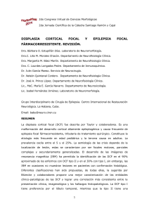 DISPLASIA CORTICAL FOCAL Y EPILEPSIA FOCAL