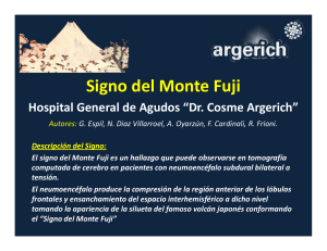 Signo del Monte Fuji