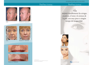 láser sciton profile profractional