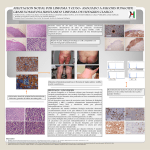 Poster. Gómez Valcarcel. Afectación nodal por linfoma T CD30+