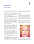 Rinoplastia