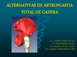 alternativas en artroplastia total de cadera