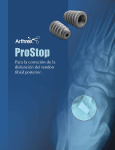 ProStop - Para la correción de la disfunción del tendón