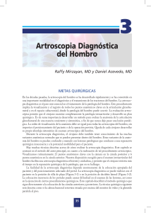 Artroscopia Diagnóstica del Hombro