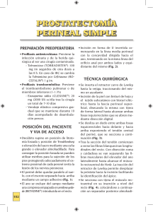 prostatectomía perineal simple