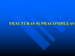 fracturas supracondileas