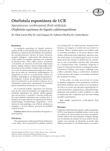 Otofístula espontánea de LCR