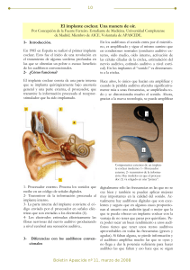 El implante coclear.