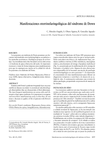 Manifestaciones otorrinolaringológicas del síndrome de Down