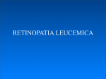 retinopatia leucemica