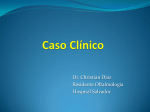 Complicaciones AVASTIN - Oftalmología Hospital del Salvador