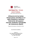 extracto: tesis doctoral