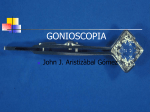 gonioscopia