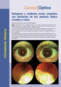 Gaceta Optica