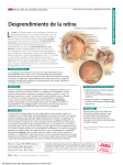 Retinal Detachment
