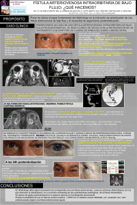 Fístula arteriovenosa intraorbitaria de bajo flujo ¿qué hacemos?