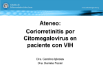 Coriorretinitis por Citomegalovirus en paciente con VIH