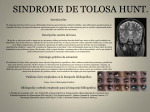 SINDROME DE TOLOSA HUNT.