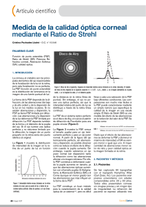 Medida de la calidad óptica corneal mediante el Ratio de Strehl